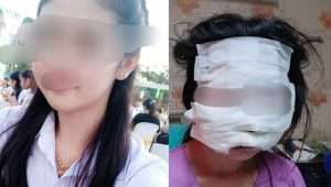 Woman Burned, Beaten by Husband Seeks Justice